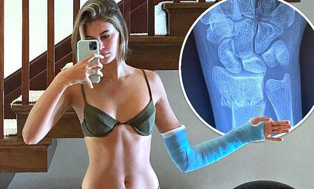 Kaia Gerber - Margaret Qualley - Cara Delevingne - Ashley Benson - Kaia Gerber posts swimsuit snap with CAST as she reveals she dislocated wrist but says 'I'm okay!' - dailymail.co.uk