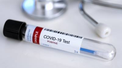 First Covid reinfection in US confirmed by researchers - rte.ie - Usa - Hong Kong - Netherlands - Belgium - Ecuador