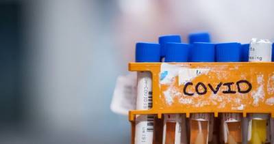 Christine Elliott - Ontario reports 81 new coronavirus cases, no additional deaths - globalnews.ca - Australia - city Hamilton - Ontario