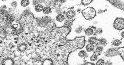 Coronavirus - Canada adds 1,454 COVID-19 cases as diagnoses soar in Ontario, Quebec - globalnews.ca - Canada - county Ontario