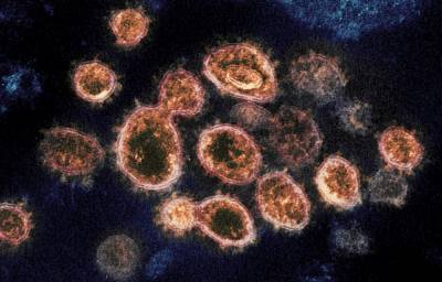Virus variant from South Africa detected in US for 1st time - clickorlando.com - Usa - state South Carolina - South Africa - Columbia, state South Carolina - Charleston, state South Carolina