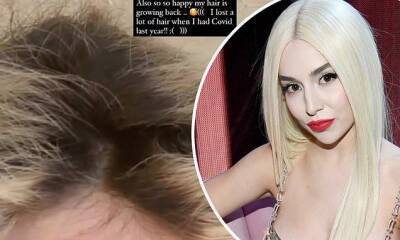 Ava Max says her 'hair is growing back' after dealing with hair loss after COVID-19 battle in 2020 - dailymail.co.uk - Usa