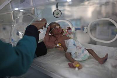 Health - UN: Over 2 million Yemeni children may starve in 2021 - clickorlando.com - Yemen