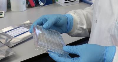 New coronavirus antibody tests with nearly 100% accuracy created by Scottish university - dailyrecord.co.uk - Scotland - city Aberdeen