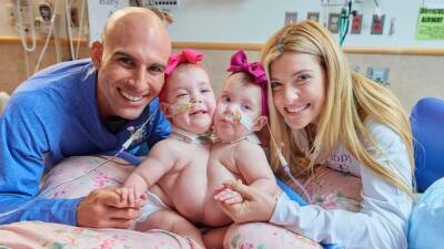 Conjoined twin girls, joined at chest, successfully separated by CHOP surgeons - fox29.com - city Chicago