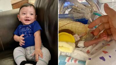 Micro-preemie born 11.5 ounces celebrates 1st birthday after 127-day stay in NICU - fox29.com - state New Mexico