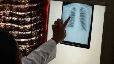 Mansukh Mandaviya - Covid restrictions hit fight against TB, cases jump 19% in 2021 - livemint.com - city New Delhi - India - state These - city Delhi