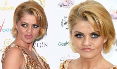 Sam Mitchell - Danniella Westbrook to undergo £500k facial surgery on NHS to ‘survive’ after health woes - express.co.uk
