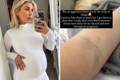 Alex Bowen - Pregnant Olivia Bowen shows off painful looking bruises on her arm as she reveals health condition - thesun.co.uk