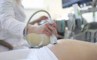 COVID vaccine in early pregnancy not tied to birth defects - cidrap.umn.edu - state Maryland - county Miller