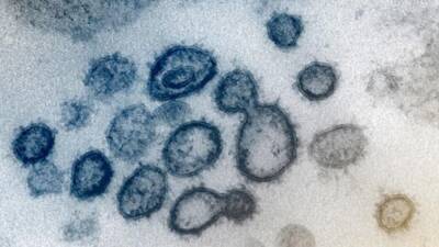 Nancy Pelosi - Chip Somodevilla - New COVID-19 outbreaks give US glimpse at living with the virus: 'Get used to it' - fox29.com - Usa - city New York - city Seattle - Washington - state New Jersey - state Connecticut - city Georgetown