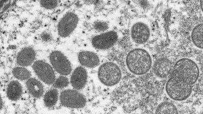 Rochelle Walensky - 9 Monkeypox cases reported in 7 states, CDC says - fox29.com - New York - Congo - state California - state Florida - Washington - state Massachusets - state Virginia - state Utah
