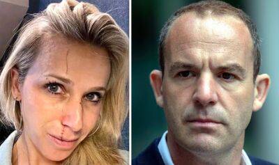 Martin Lewis - Martin Lewis sparks concern with health update after wife's accident ‘Feeling cr*p!’ - express.co.uk
