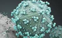 Johns Hopkins - HIV may predispose to post-vaccination COVID, requiring extra doses - cidrap.umn.edu - Usa - state California - state North Carolina - county Atlantic - county Hill