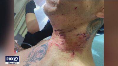 Video: San Jose K-9 bites man’s throat for 1 minute re-igniting police dog concerns - fox29.com - Germany - city San Jose
