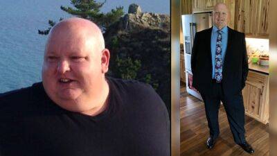 Man loses 156 lbs. in 9 months with diet and exercise: ‘If I can do it, anybody can’ - fox29.com
