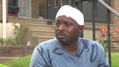 Mike Jerrick - Officer injured during 4th of July fireworks in Philadelphia shares his experience - fox29.com - county Montgomery - city Philadelphia