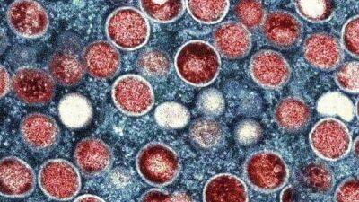Tedros Adhanom Ghebreyesus - Why monkeypox outbreak is a public health emergency? WHO chief lists 2 crucial reasons - livemint.com - India - Britain - Nigeria