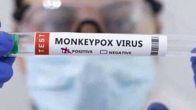 ‘Monkeypox shows signs of slowing’: What UK health agency said - livemint.com - Usa - India - Britain - city London, Britain