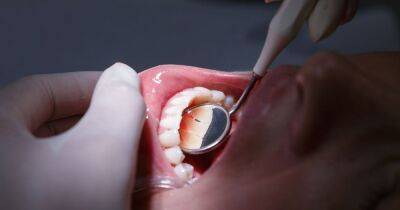 Poor dental health may increase risk of dementia, claims study - dailyrecord.co.uk - Usa - Britain