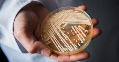 ‘Worsening spread’ of deadly fungal infection raising alarm in U.S. - globalnews.ca - Usa - Canada - state Mississippi