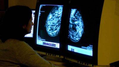 Artificial intelligence model to help scientists predict whether breast cancer will spread - fox29.com - Usa