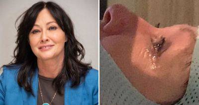 Shannen Doherty - Shannen Doherty says breast cancer has spread to her brain: ‘My fear is obvious’ - globalnews.ca - Los Angeles